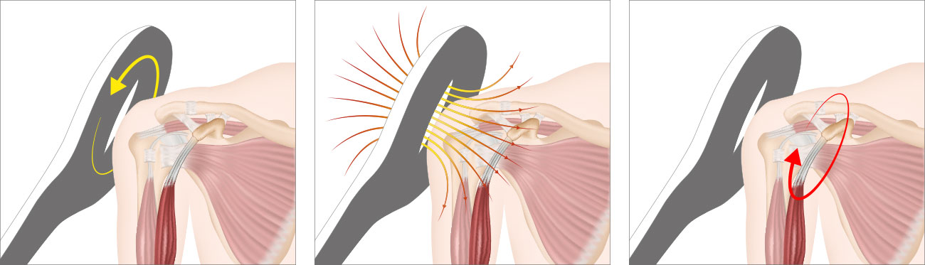 Electromagnetic stimulation