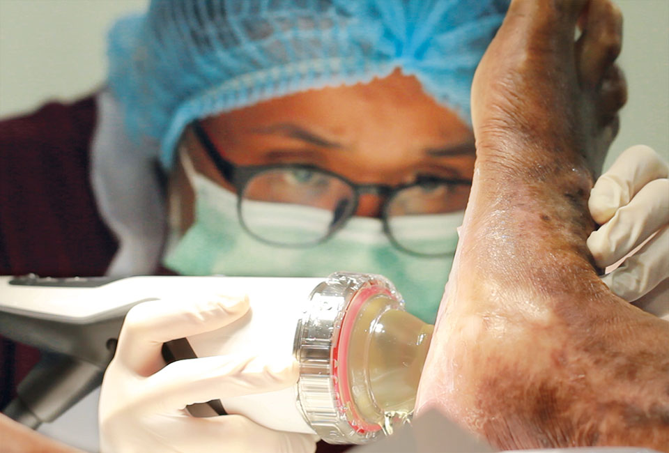 Wound healing