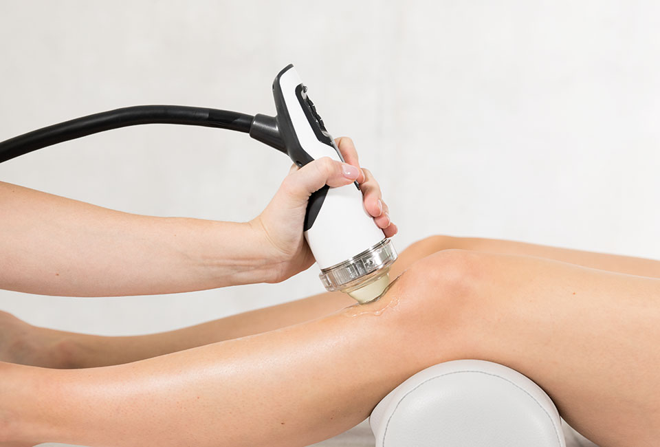 Patellar tendinitis