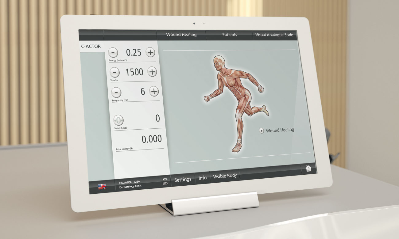 Touch screen – The ideal add-on to the DUOLITH® SD1 T-TOP »ultra«