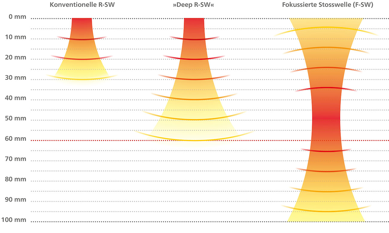 Vergleich Eindringtiefen im Massstab
