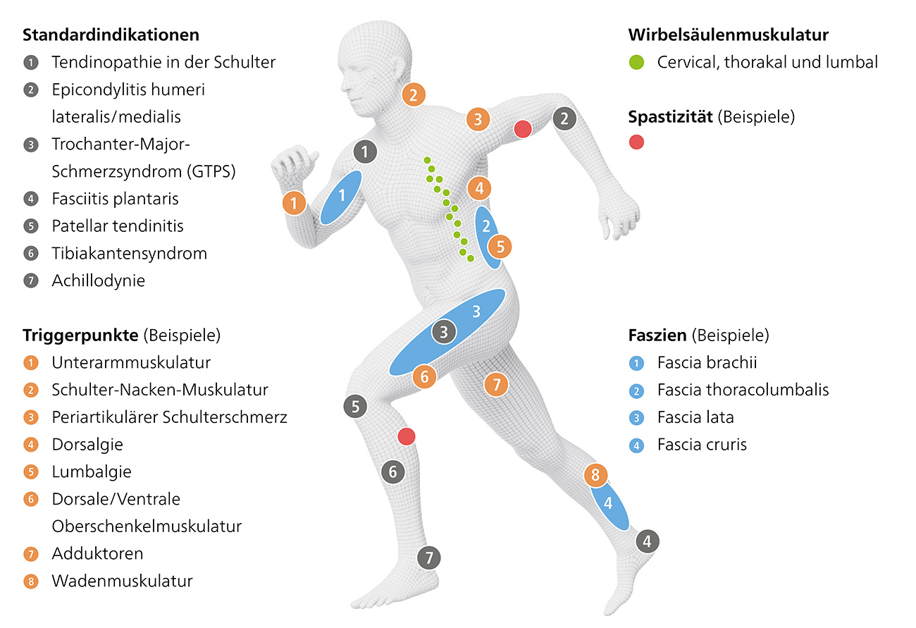 MASTERPULS icon - Indikationen