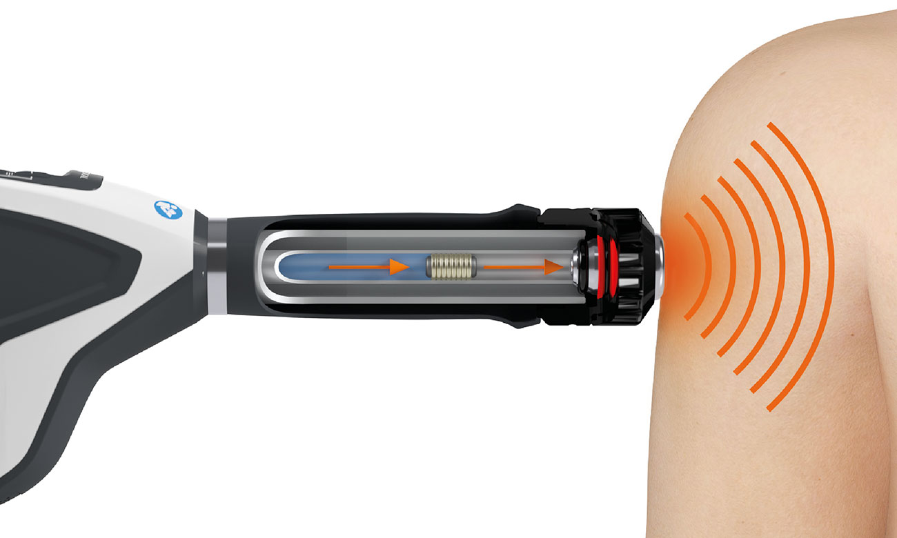 Transmission of the radial shock wave into the tissue with the MASTERPULS handpiece