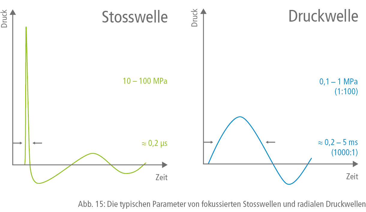 Die typischen Parameter von fokussierten Stosswellen