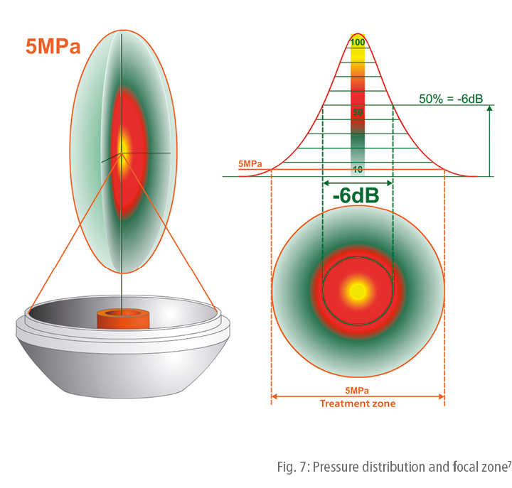 Pressure distribution and focal zone
