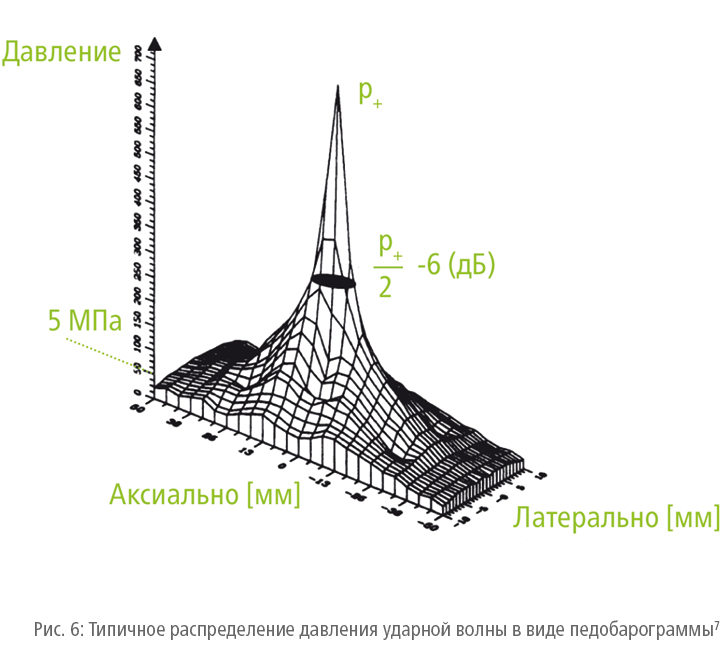 Типичное распределение давления ударной волны в виде педобарограммы